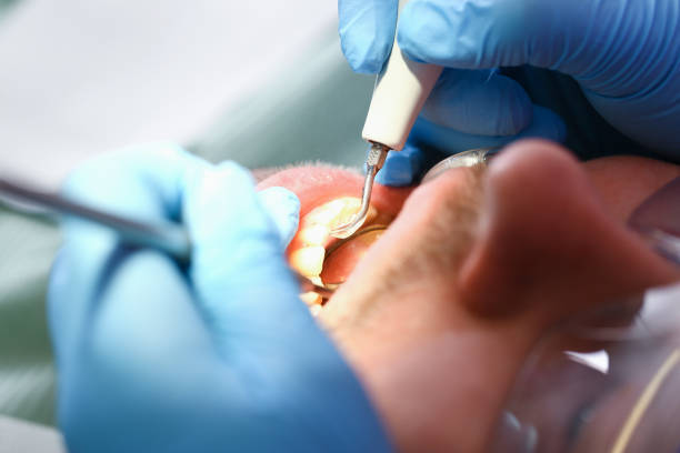 Best Urgent Tooth Repair  in Amesti, CA